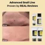 cosrx all about snail kit 4 – step