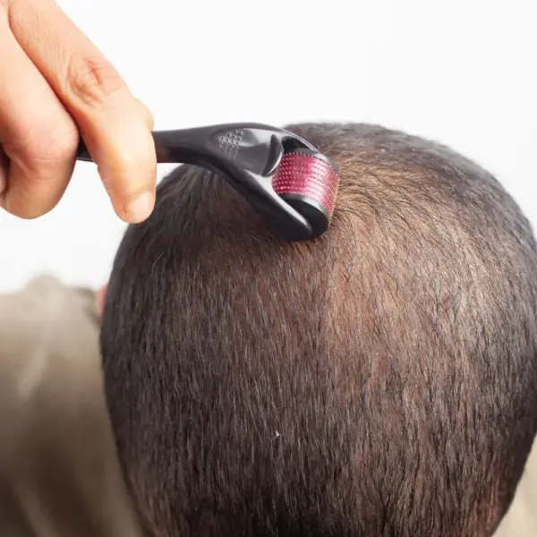 derma roller