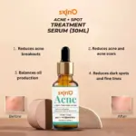 skin'o acne + spot treatment serum 30ml