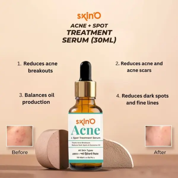 skin'o acne + spot treatment serum 30ml